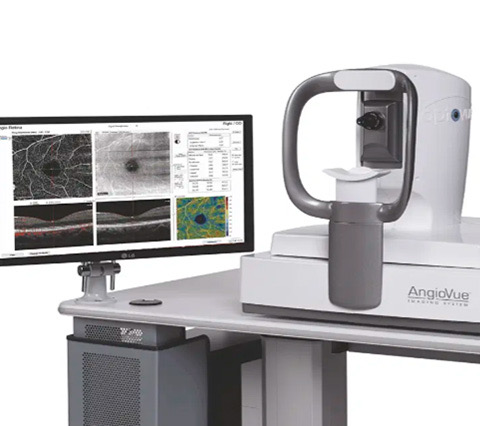 OCT CIRRUS 6000 ZEISS para tomografía de coherencia óptica y detección de glaucoma en Bogotá