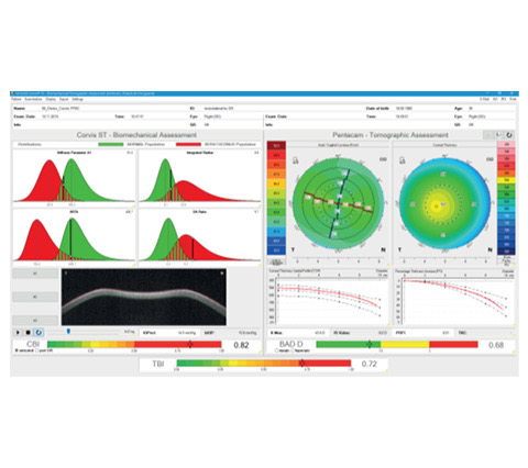 Corvis ST para medición de rigidez corneal y presión intraocular en Bogotá